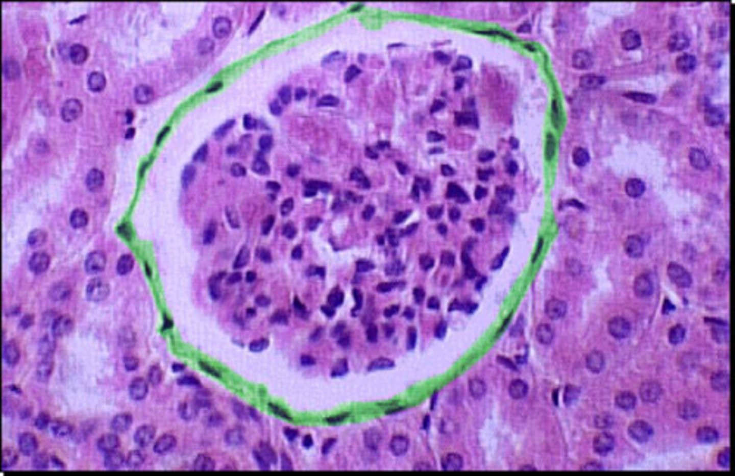 <p>Inside the green part</p>