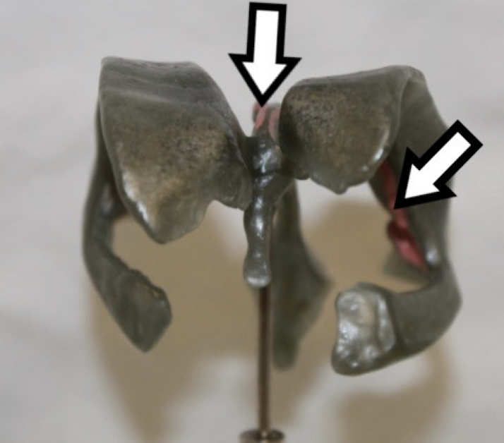 <p>identify this structure (pink area)</p>