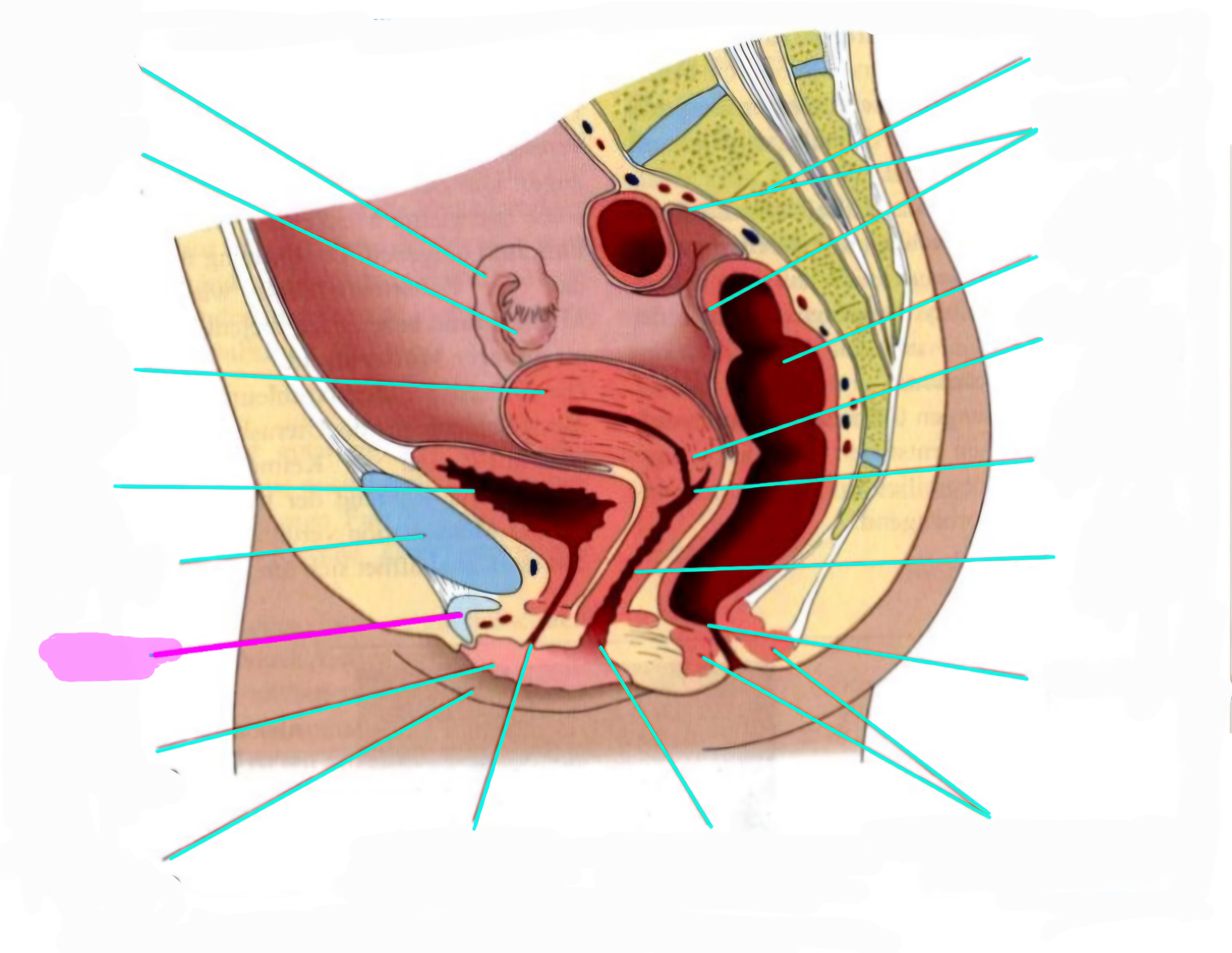 term image
