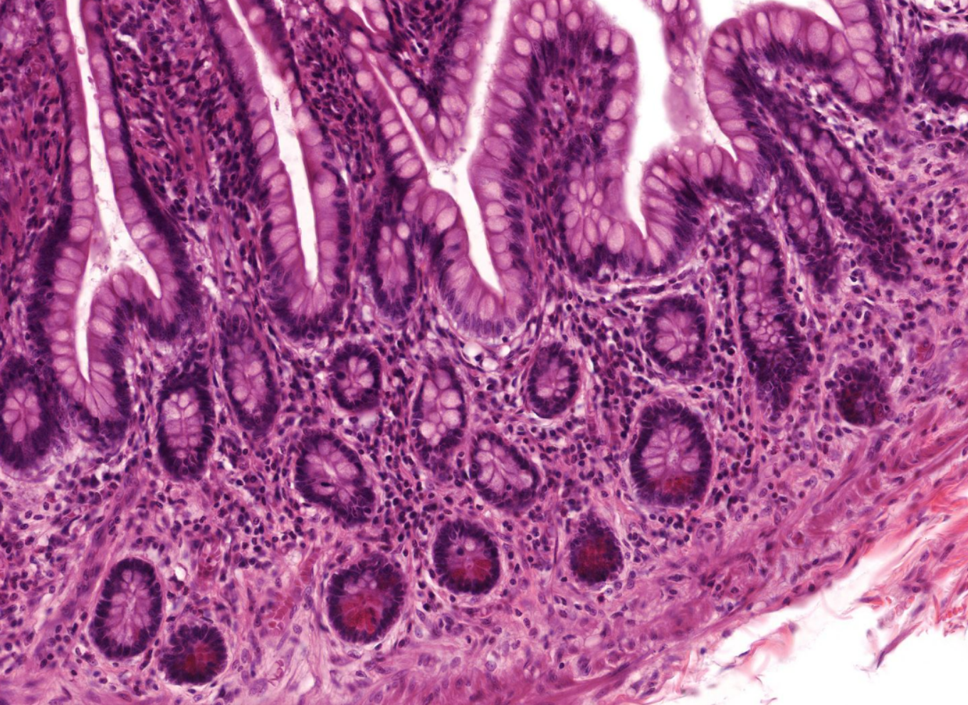 <p>Strongly eosinophilic staining cells near base of crpts?</p><p>Organ? which region most often?</p>