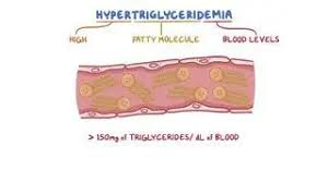 <ul><li><p>high TG (chylomicrons, VLDLs)</p></li></ul><p></p>