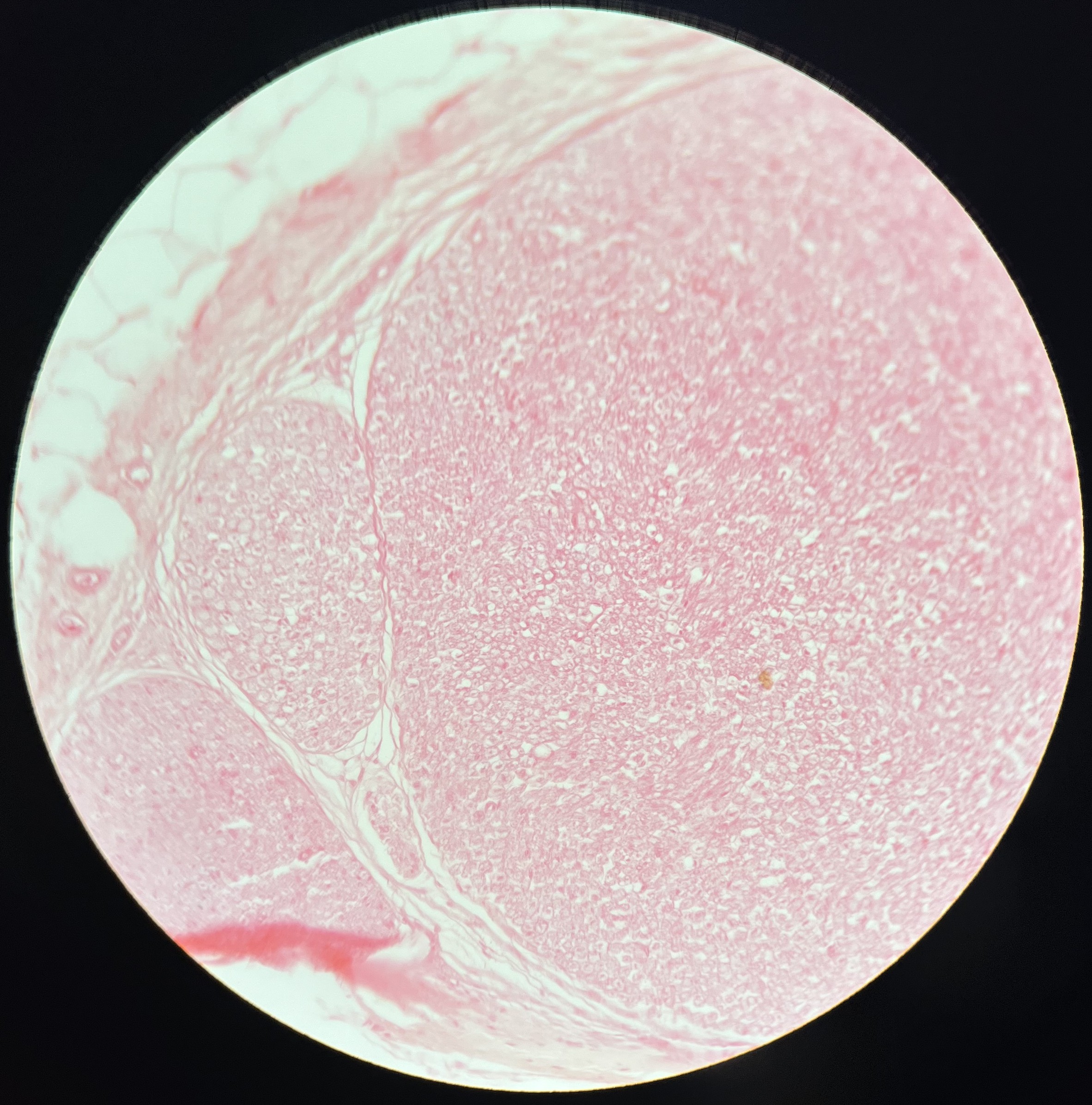 <p>What kind of tissue is this?</p>