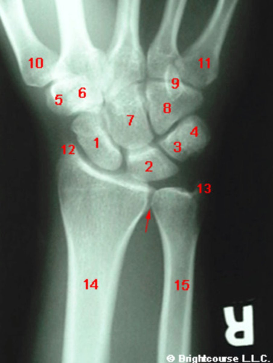 <p>What structure is indicated by number 12?</p>