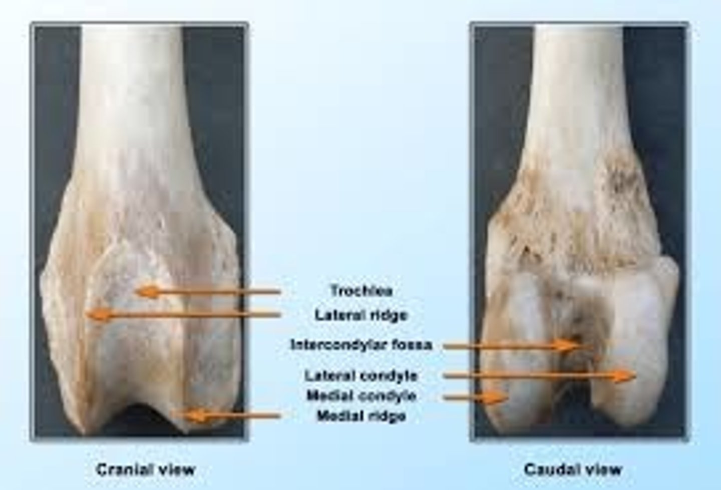 <p>deep depression located between the condyles and beneath the popliteal surface</p>