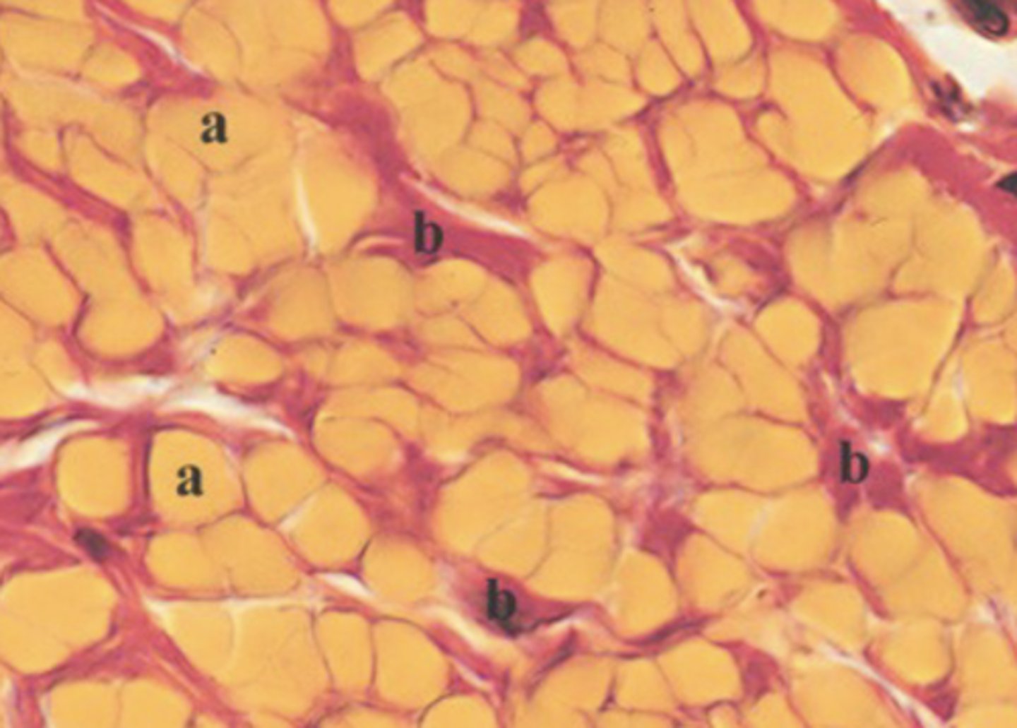 <p>What type of connective tissue is shown in the image?</p>