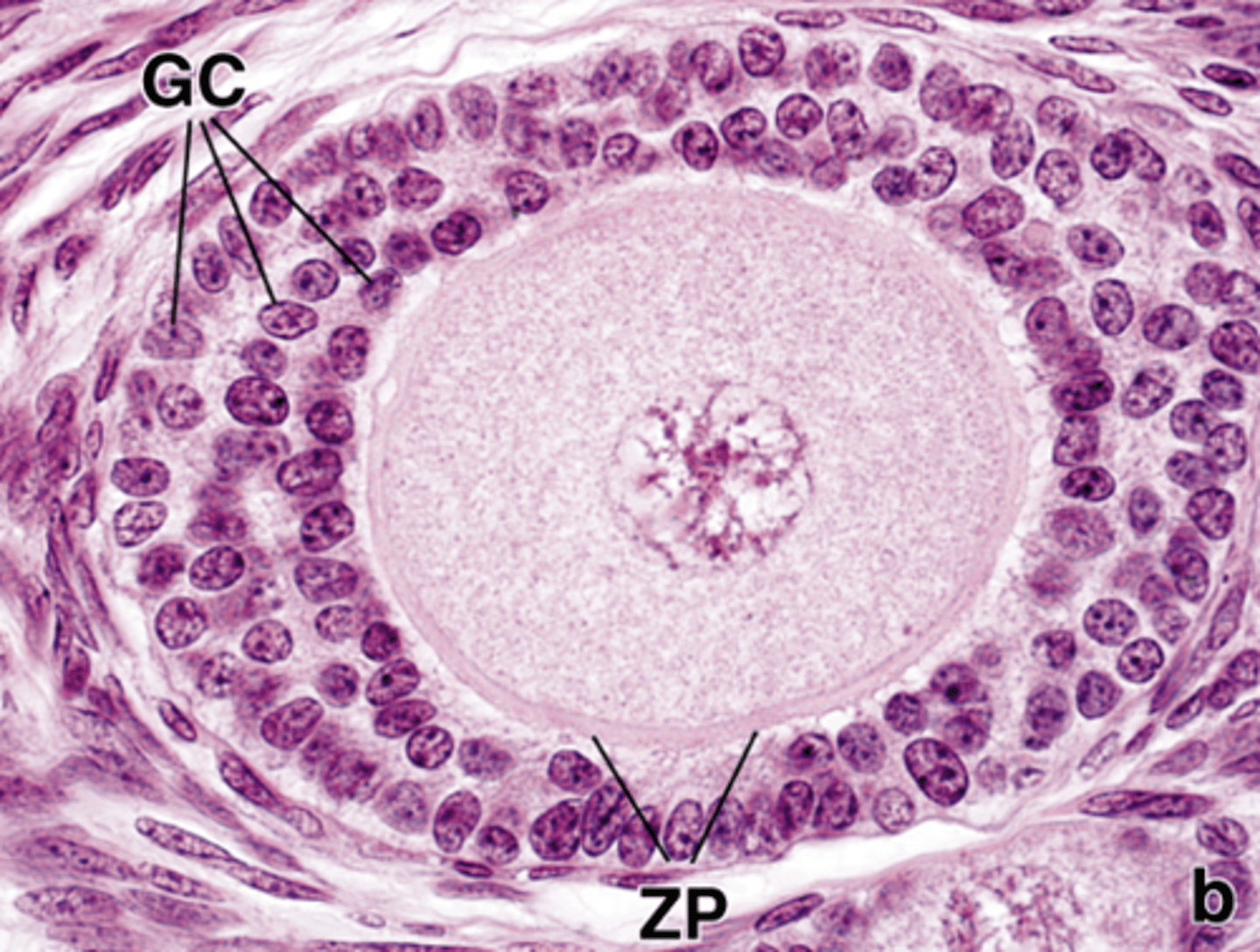 <p>What type of follicle?</p>