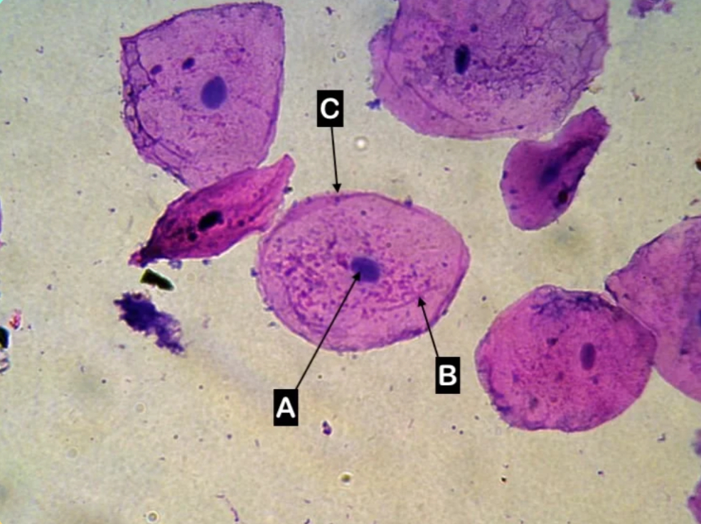 <p>Which letter is pointing to the cell membrane of the cell?</p>