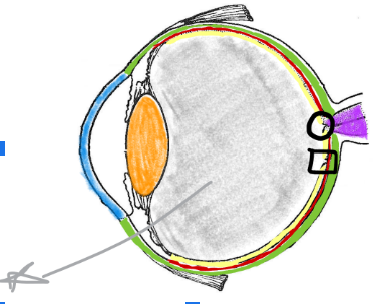 <p>Vitreous humor</p>