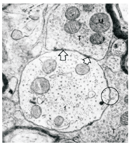 <ul><li><p>Resolution up to the nanoscale (x10<span style="color: black"><sup>-9</sup></span>)</p></li><li><p>Synapses &amp; individual organelles visible</p></li></ul>