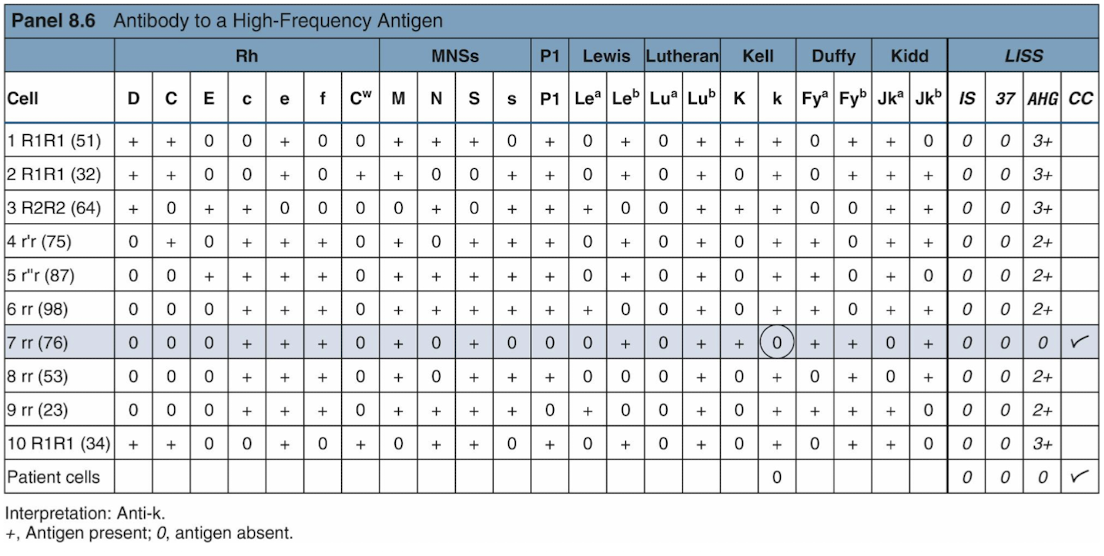 <ul><li><p>High-frequency Ags occur in the pop. at a frequency of 98% or higher</p></li><li><p>Suspect an alloantibody to a high-frequency Ag if most panel cells are positive</p></li><li><p>Testing to confirm include:</p><ul><li><p>Enzymes to enhance or destroy Ags</p></li><li><p>Dithotheritol to destroy Kell Ags</p></li></ul></li></ul><p></p>