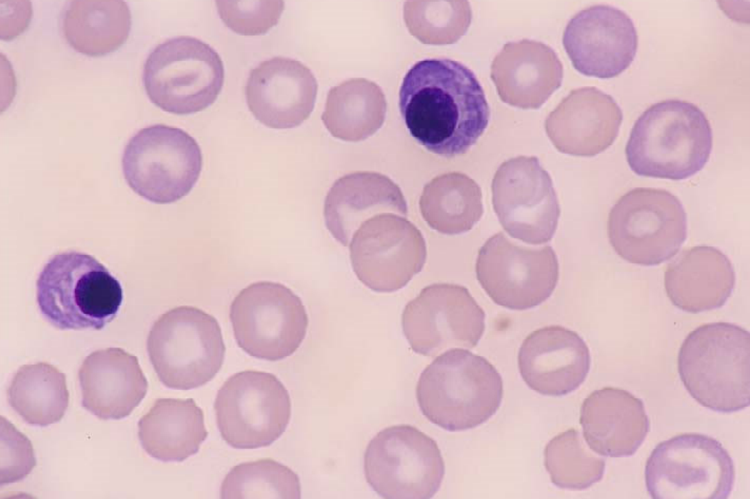 <ul><li><p>metarubricytes/rubricytes</p></li><li><p>normal feature of immature RBCs but <strong>usually not in circulation</strong></p></li><li><p>(avian/reptile RBCs are nucleated)</p></li></ul><p></p>