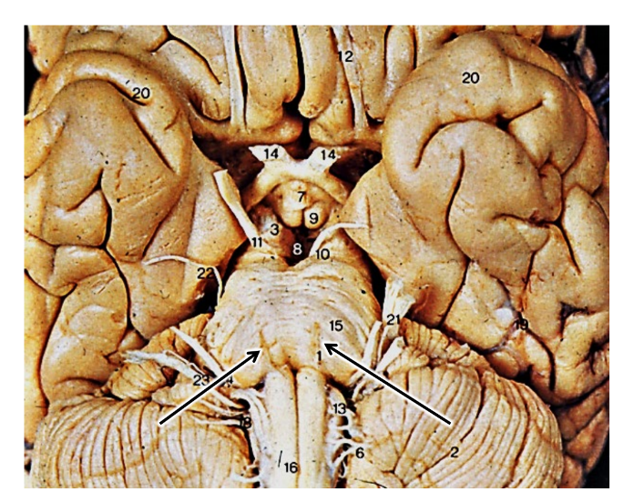 <p>what are the arrows pointing at?</p>