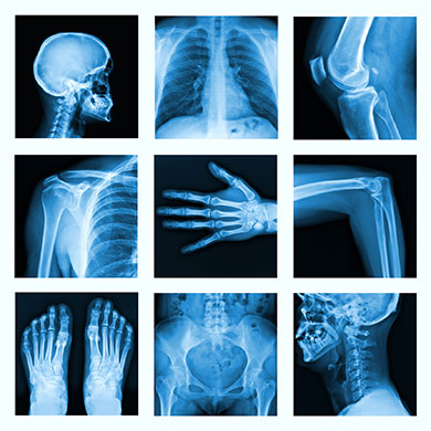 <p>X-Rays</p>