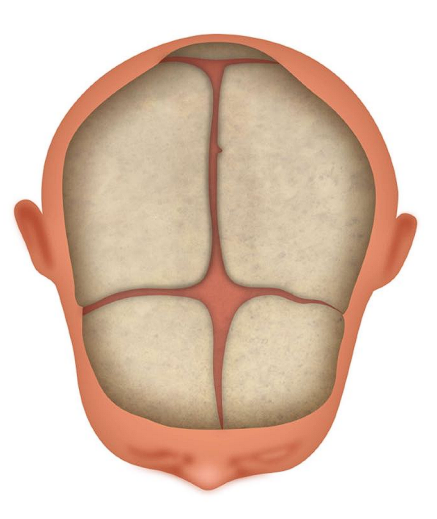 ● Soft/flat 

○ Anterior  

■ Closes between 6 and 18 mo 

○ Posterior  

■ Closes by 2 months  
