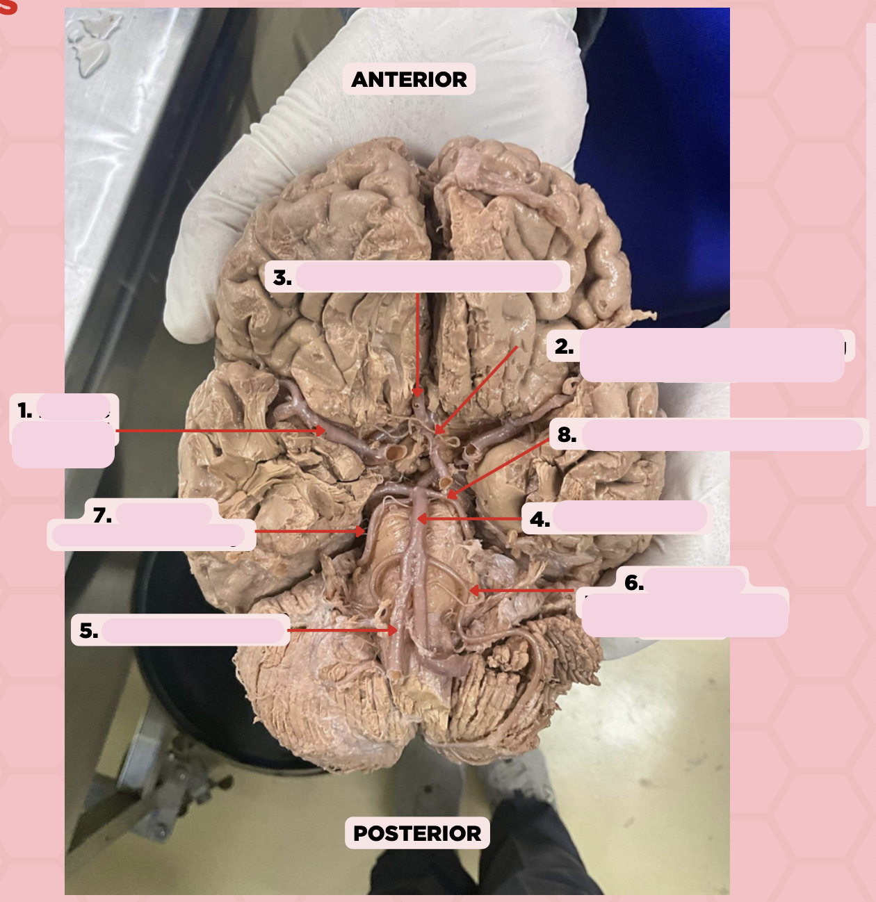 <p>Identify the structure labeled as 3.</p>