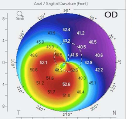 <p>Name the finding.</p>