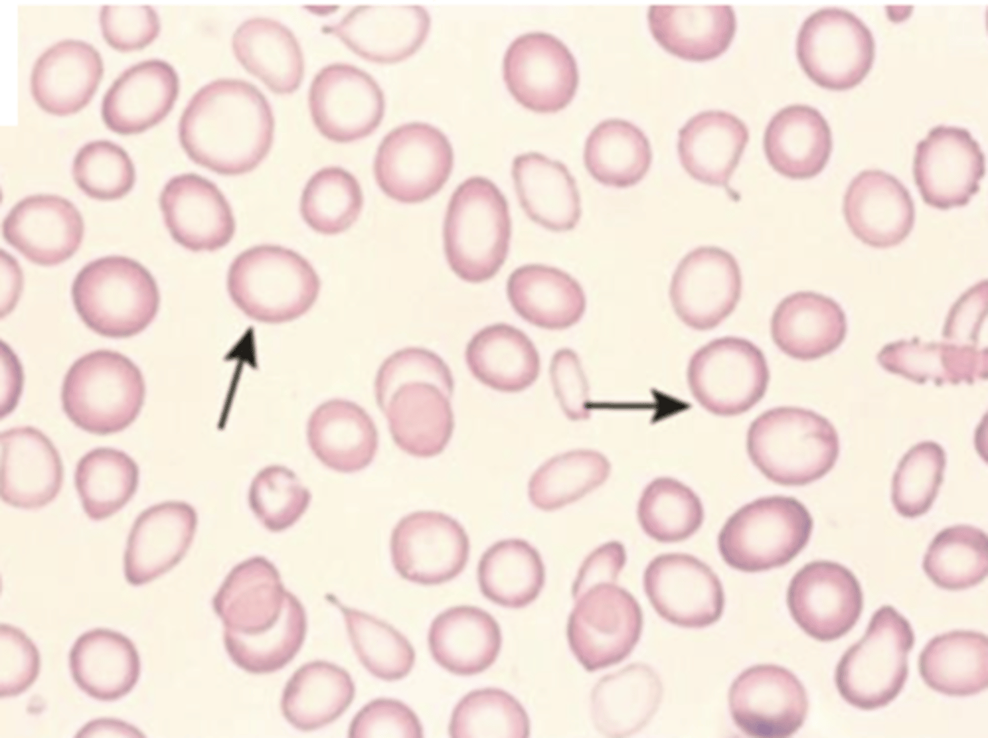 <p>decrease MCHC</p>