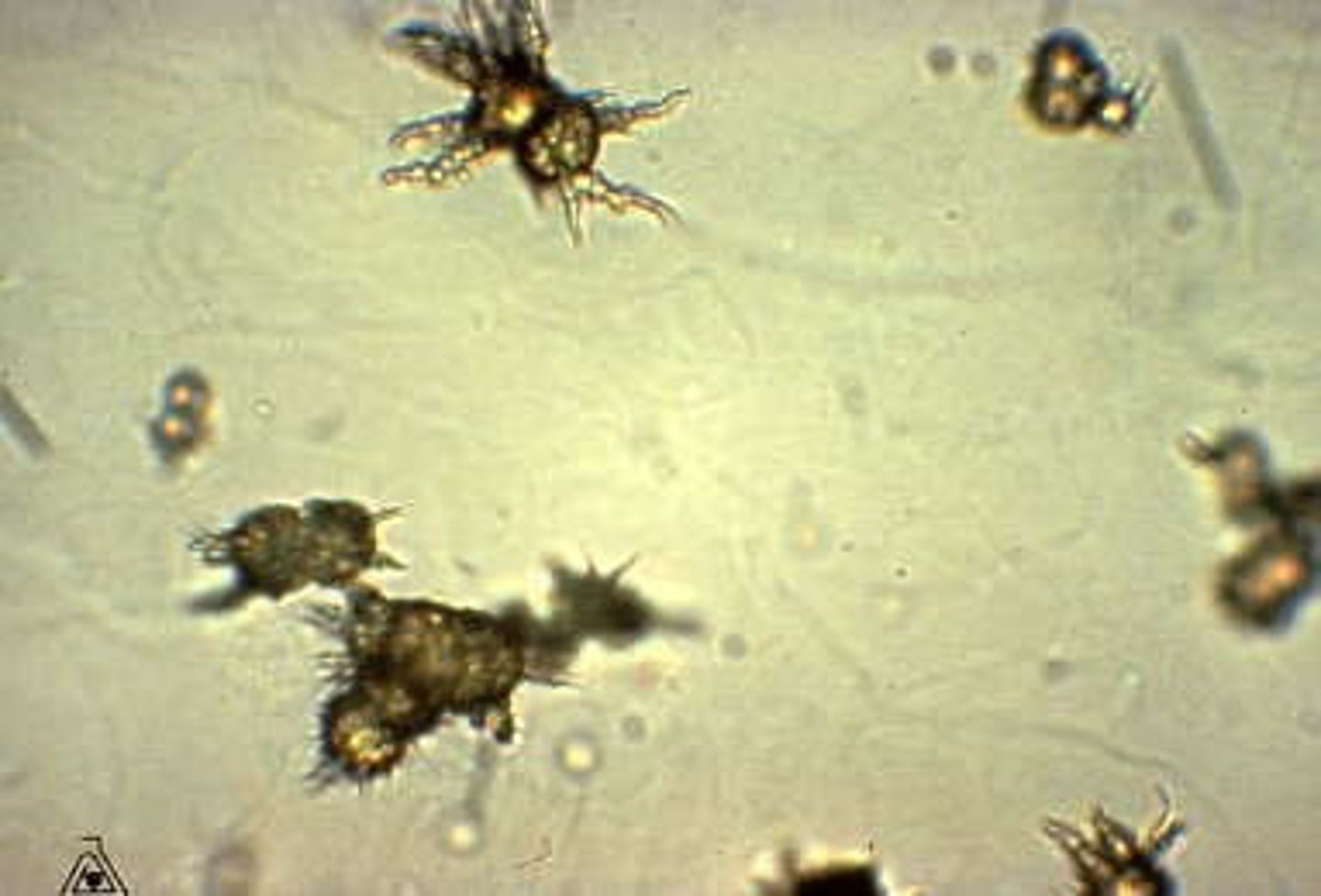<p>Round with thorny projections Dark yellow to brown. Urine pH: Alkaline</p>