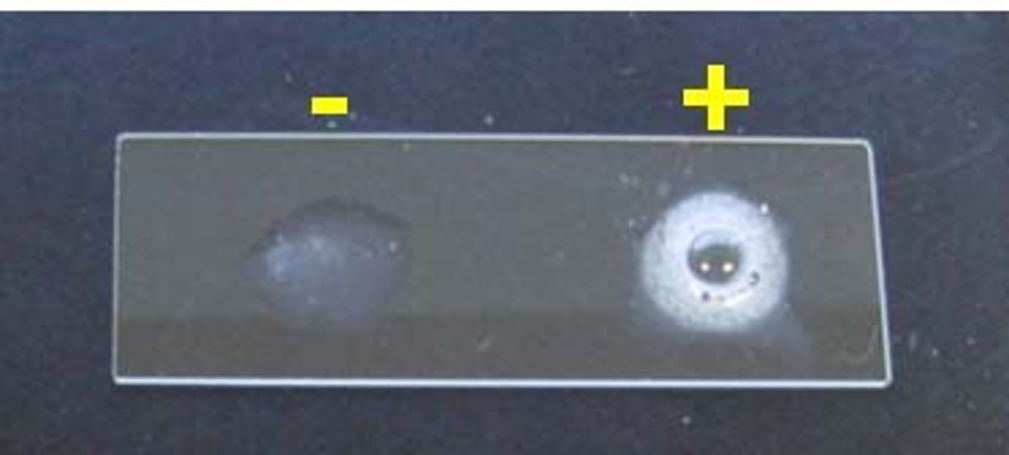 <p>positive=bubbles</p><p>negative=no bubbles</p>