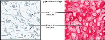 <ul><li><p>elastic fibers→ noticeable</p></li><li><p>chondrocyte</p></li><li><p>lacuna</p></li></ul><p></p>