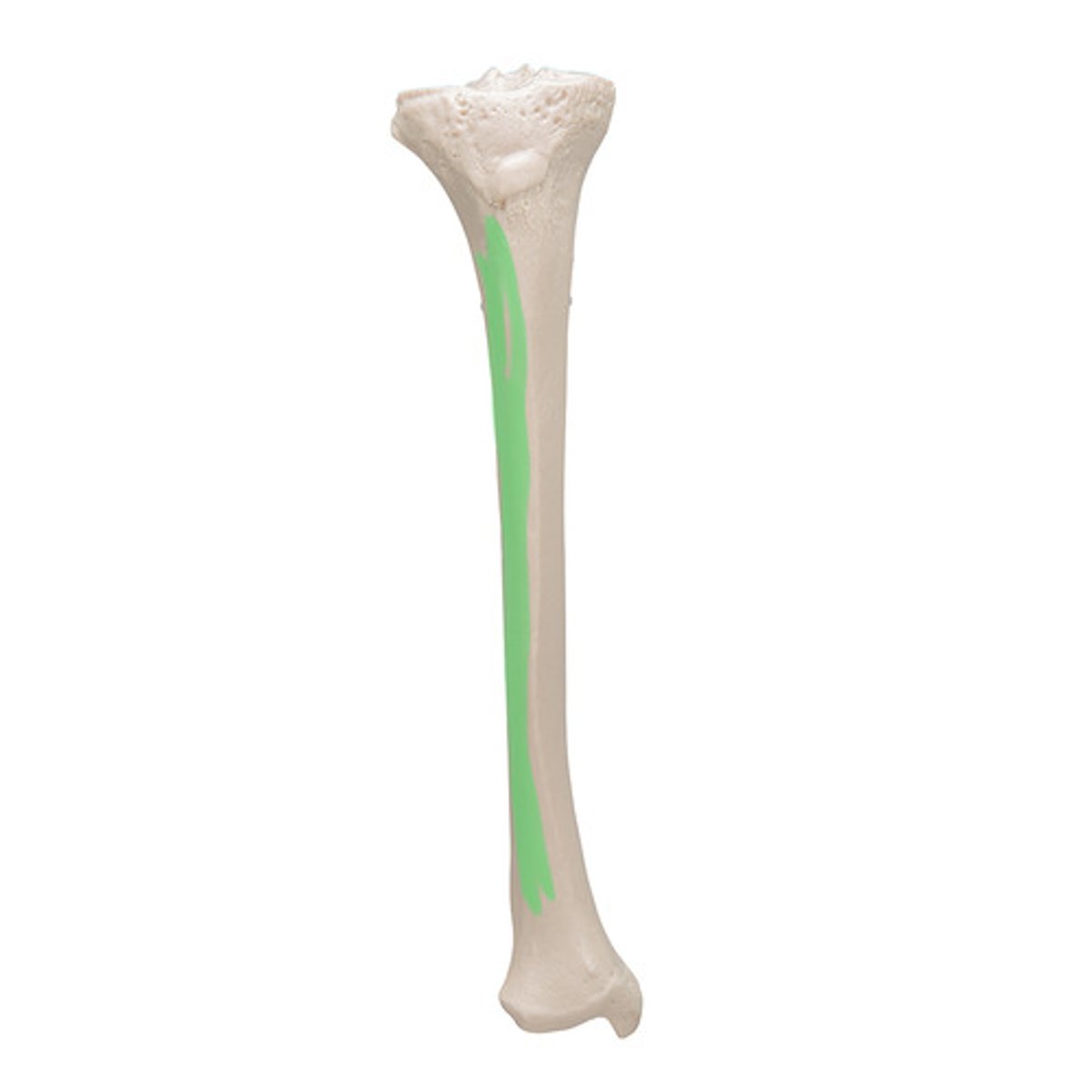 <p>of SHAFT, is lateral, opposite of FIBULA</p>