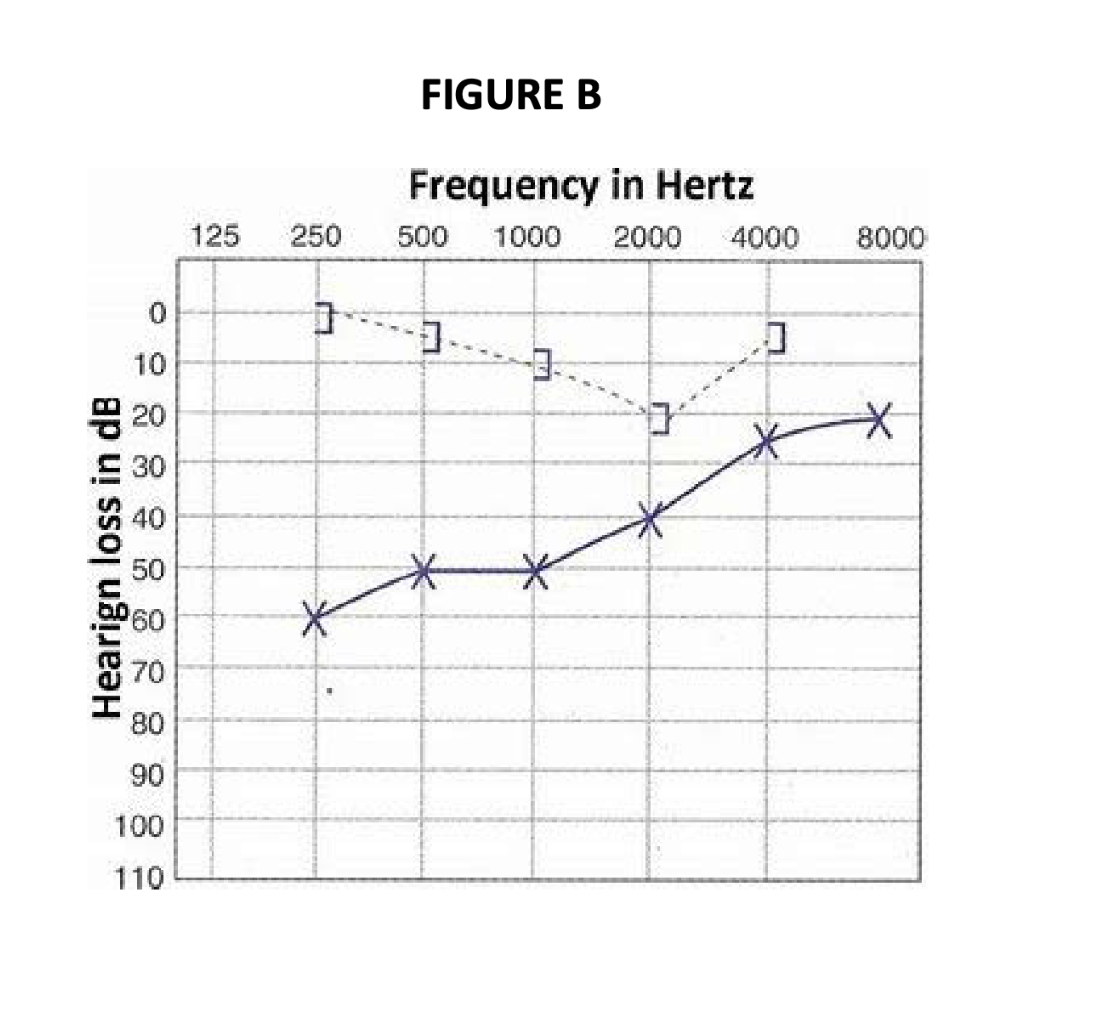 <p>the symbol “]” that appears in Figure B is being used to report _____</p>