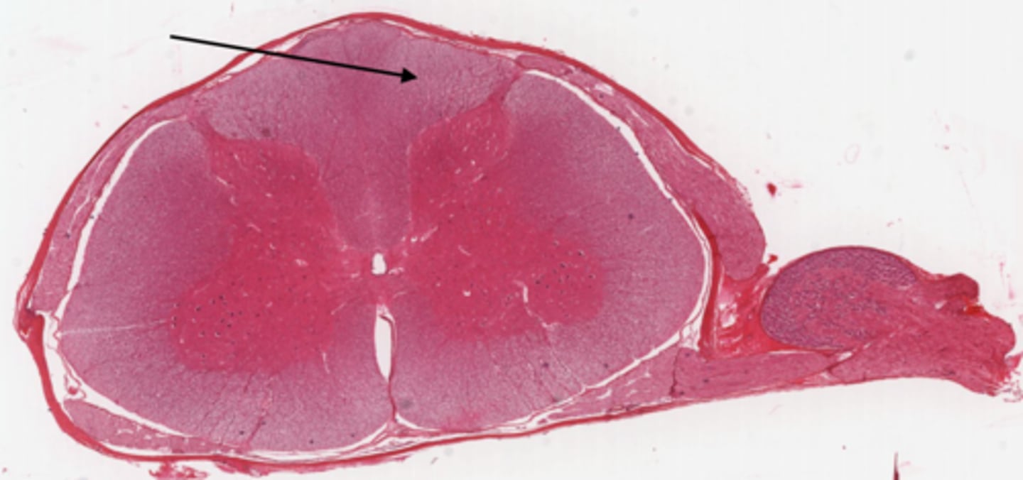 <p>Identify the part of the spinal cord</p>