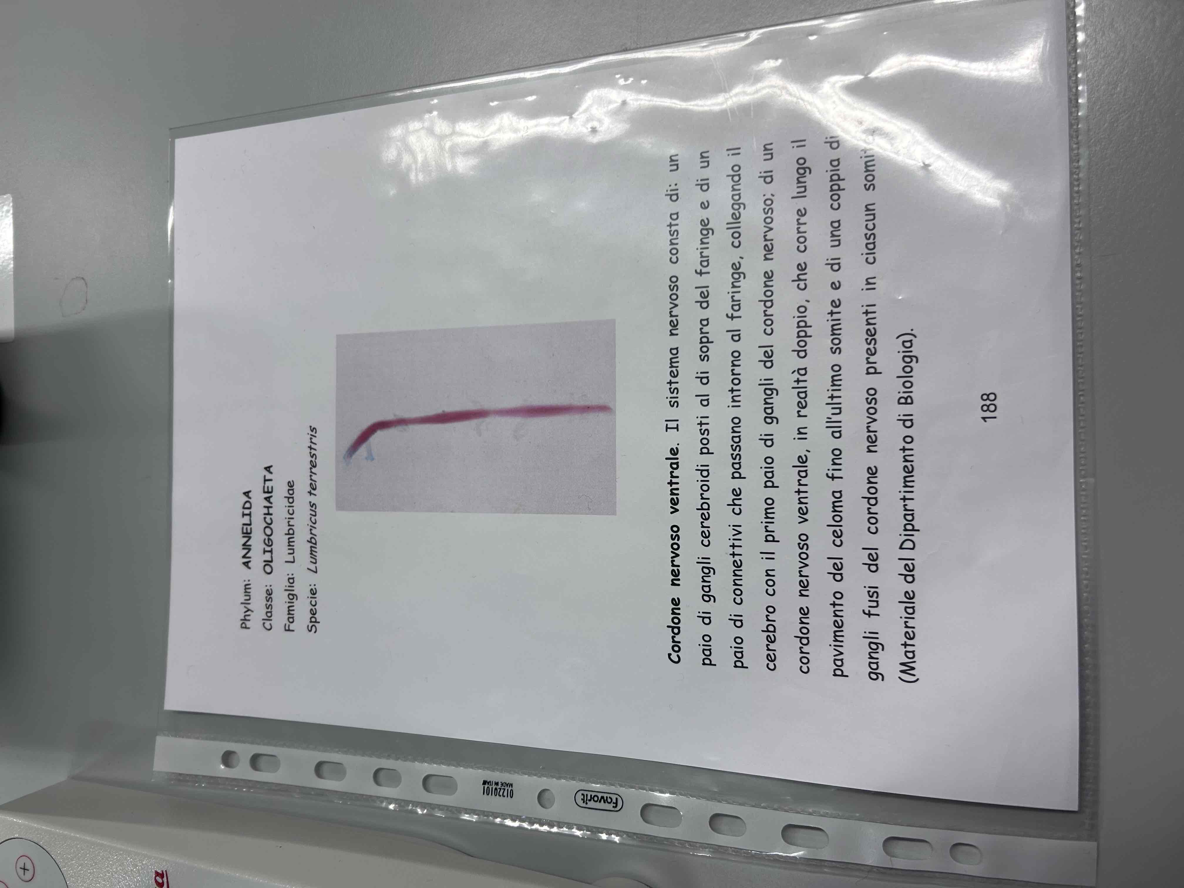 <p>Anellidi</p><p>Clitellati</p><p>Oligocheti</p><p>Lumbricus terrestris (cordone nervoso ventrale)</p>