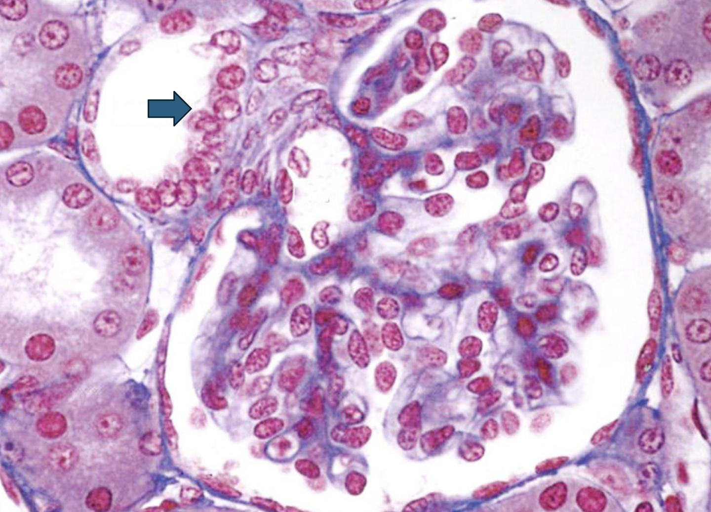 <p>What is the arrow pointing to?</p>