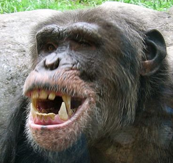 diastema