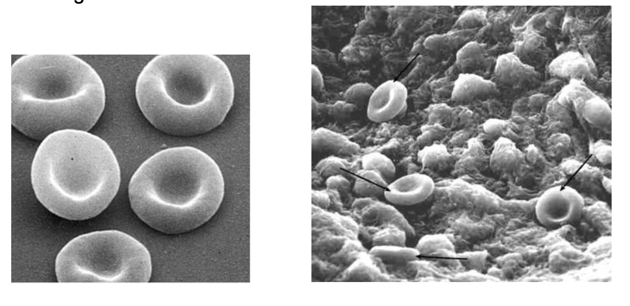 <p><span>What do these scanning electron microscope (SEM) images show about erythrocyte shape?</span></p>