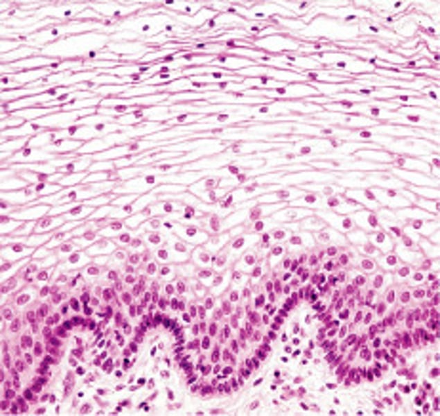 <p>name the type of epithelial tissue</p>