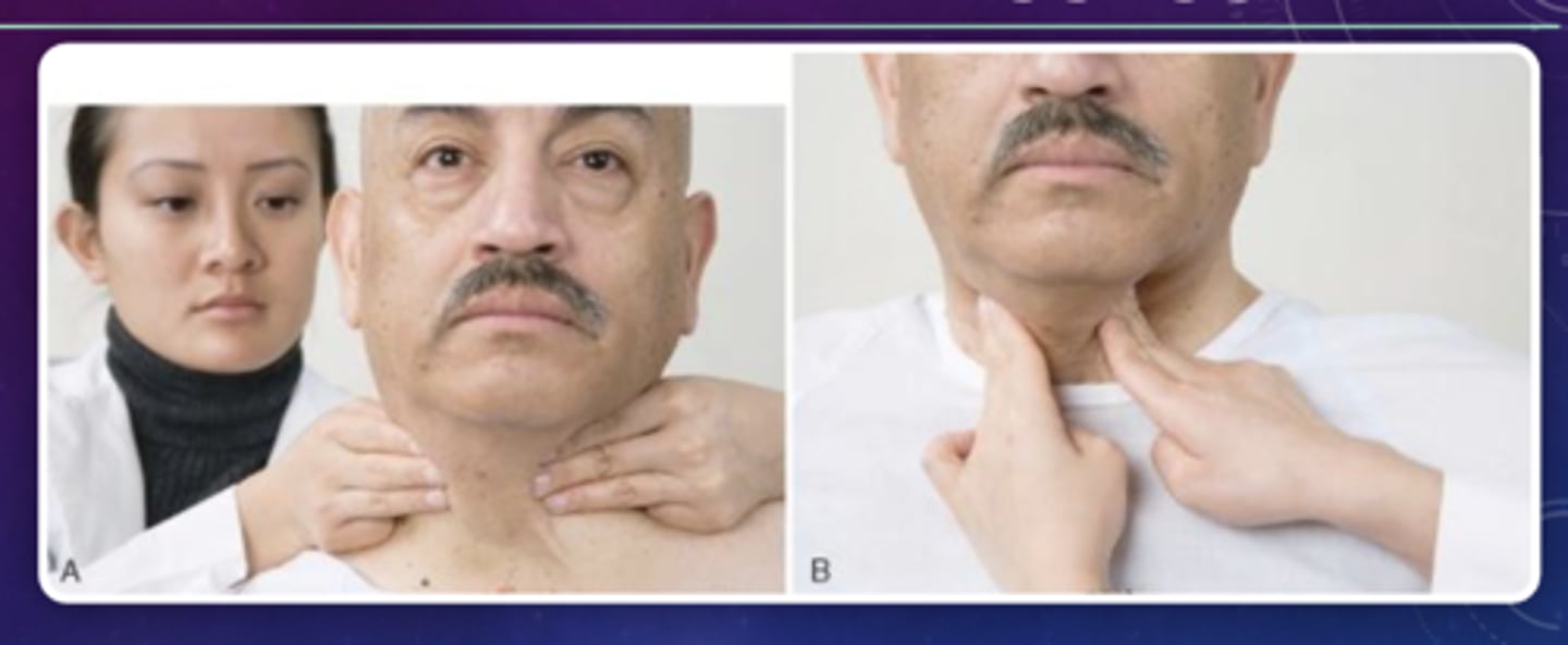 <p>Assessment of the Endocrine System:</p><p>What are important structures to assess during this?</p>