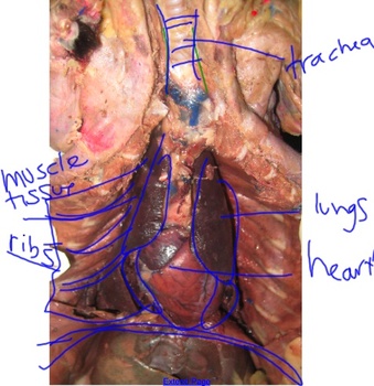 <p>Curved bones forming the skeletal framework of the chest, protecting the internal organs, such as the heart and lungs.</p>