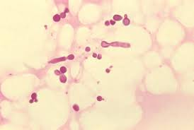 <p>Mallessezia</p>