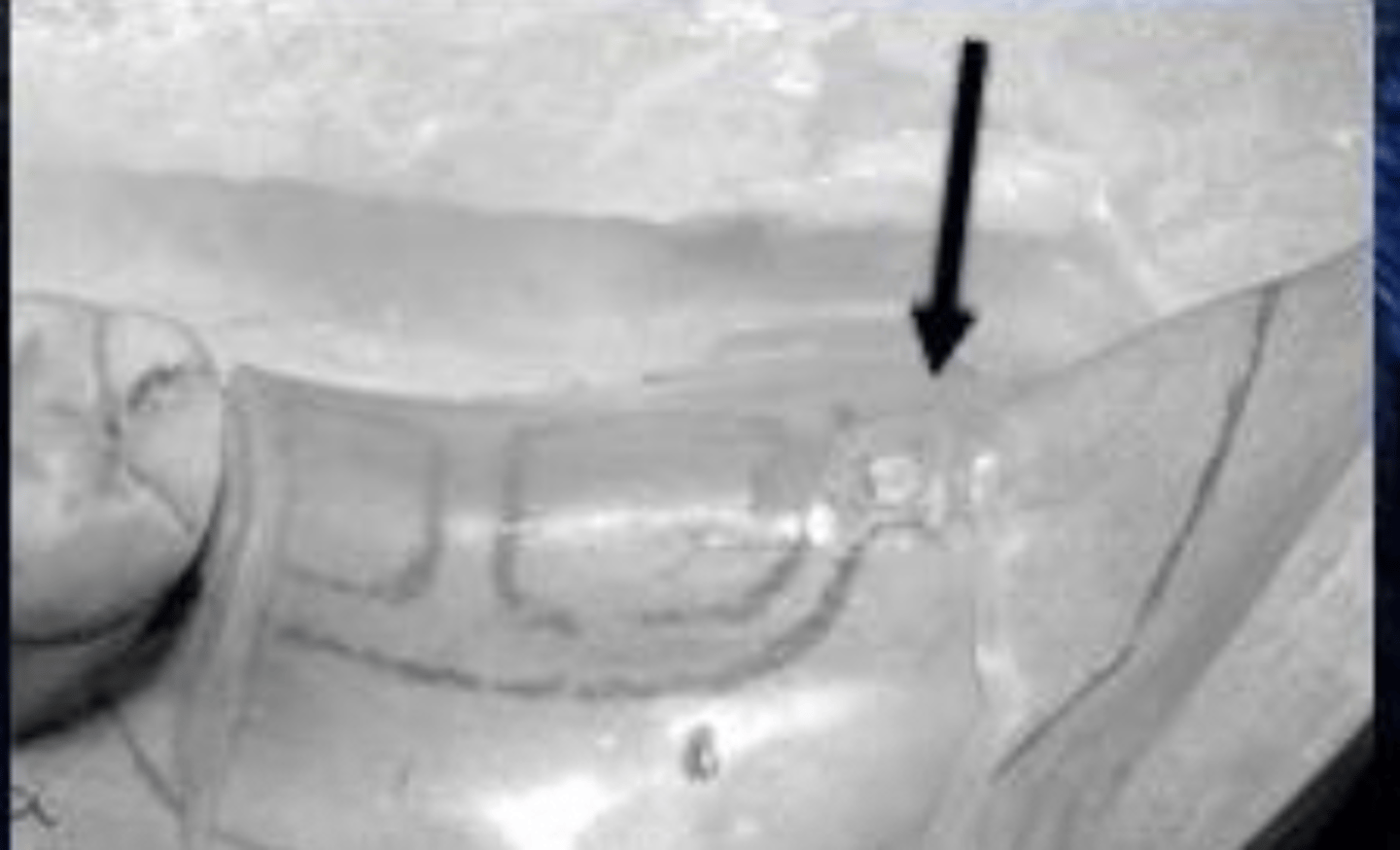 <p>What is the arrow pointing to?</p>