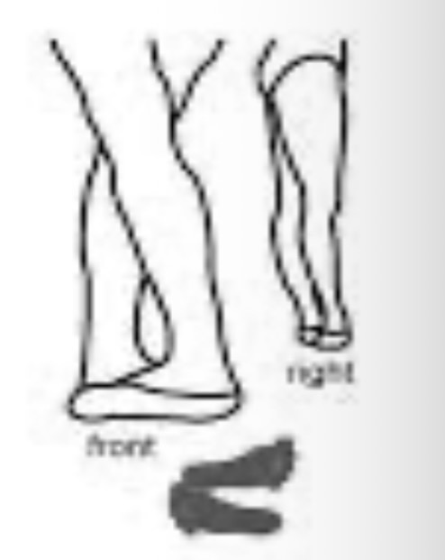 <p>5th position</p>