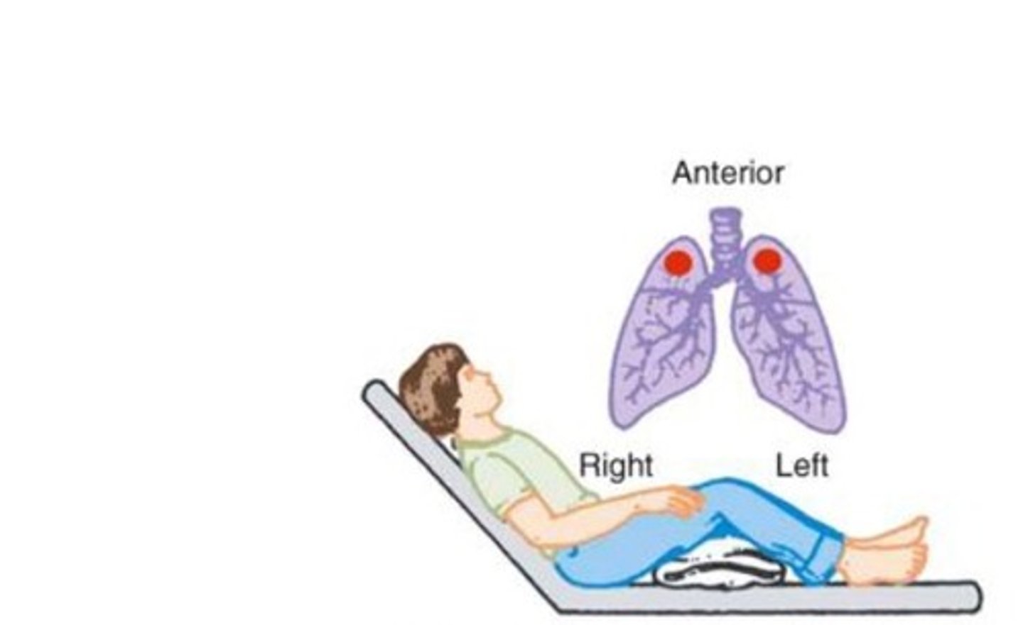 <p>- Position the patient sitting and leaning back at about a 45 degree angle.</p><p>- Area to percuss is just below the clavicle.</p>