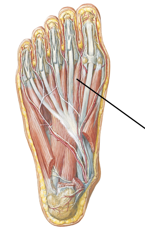 <p>Paralysis of this muscle suggests injury of what named nerve?&nbsp;</p>