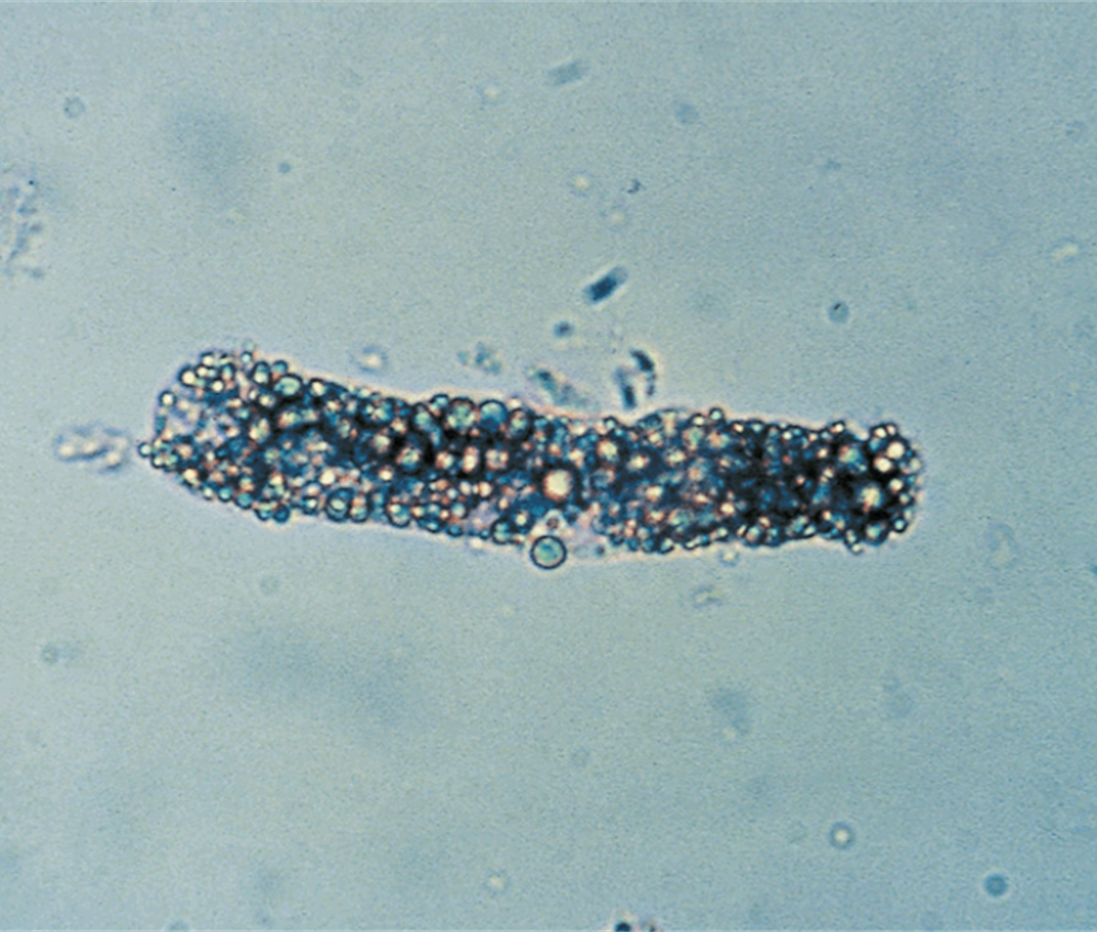 <p>Highly refractile</p>