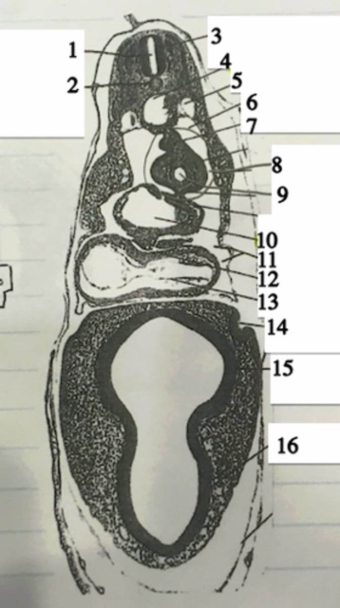 <p>#14</p>