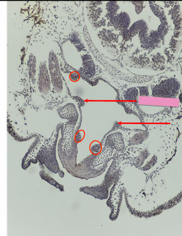 <p>what level<br>primary brain vesicle<br>parts</p>