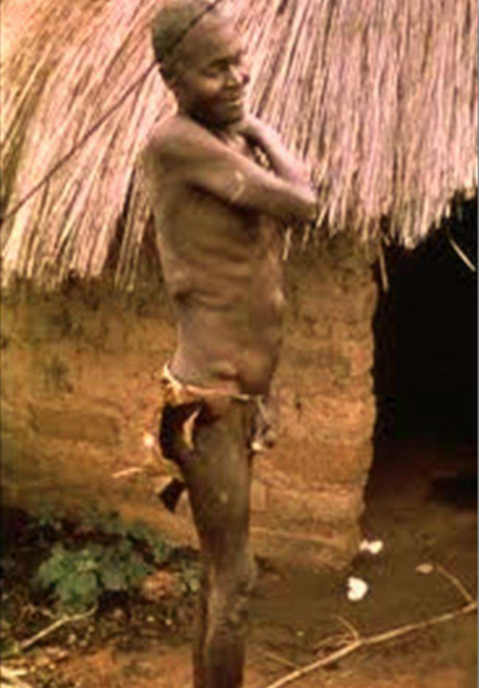 <p>Disease; caused by?</p>