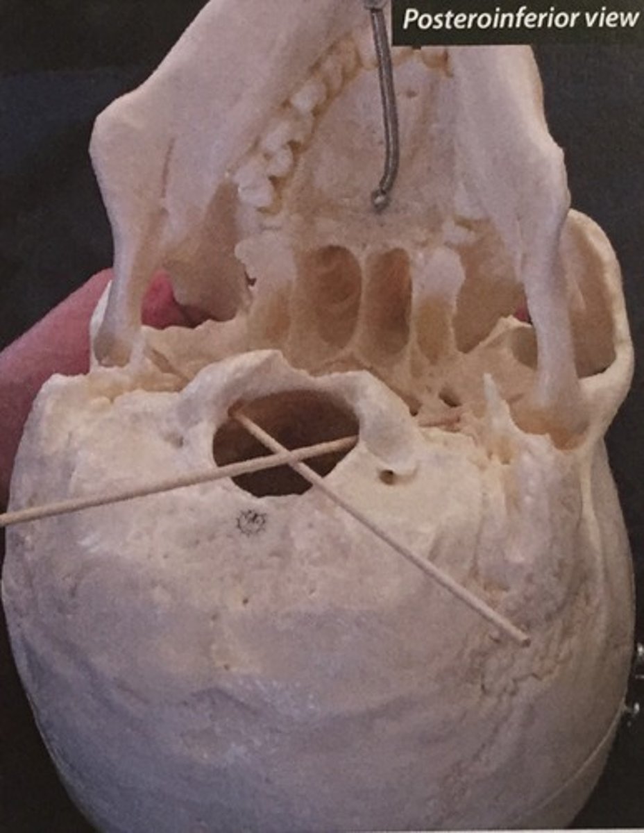 knowt flashcard image