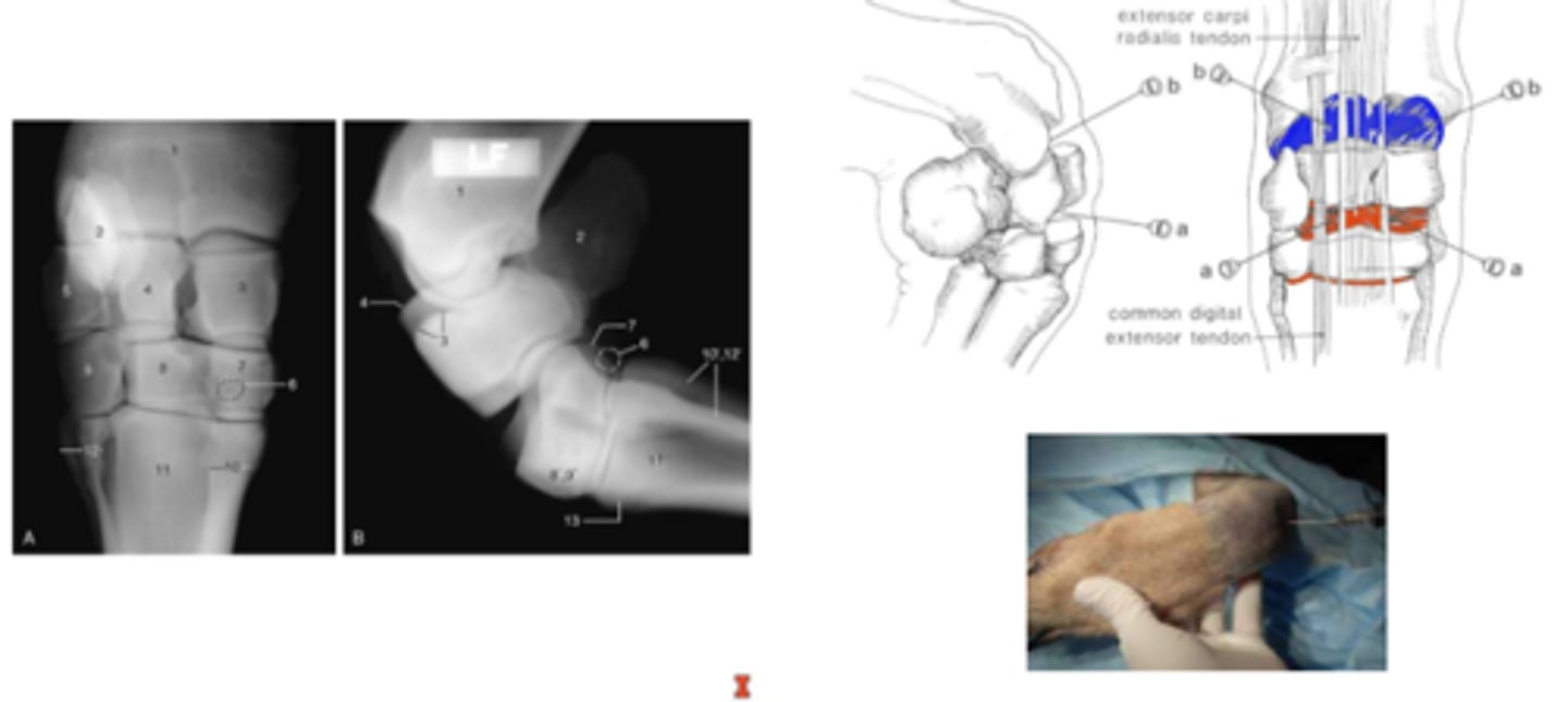 <p>separation between synovial compartments means they do not communicate and need to inject them separately</p>