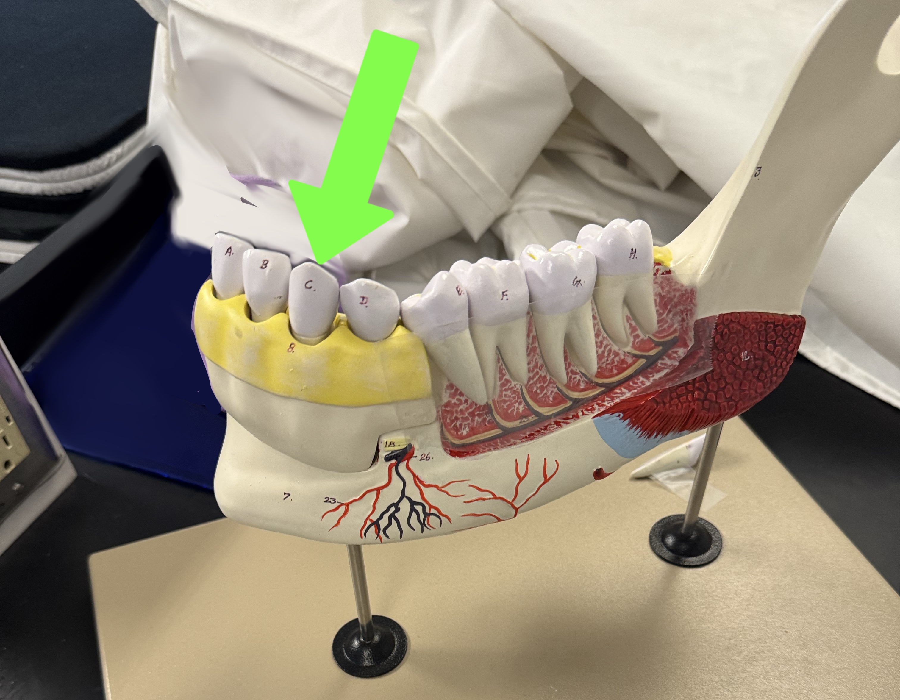<p>what type of tooth is this</p>