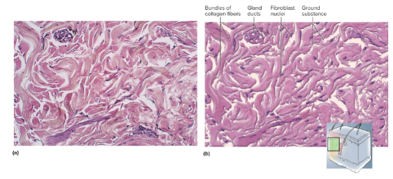 <p>Dense irregular connective tissue</p>