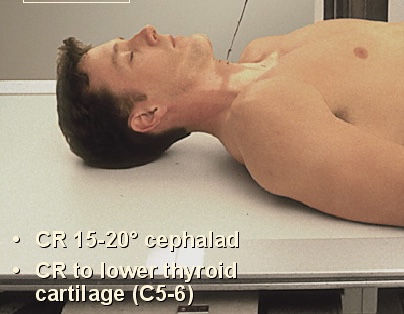 <p>What position is this?</p>