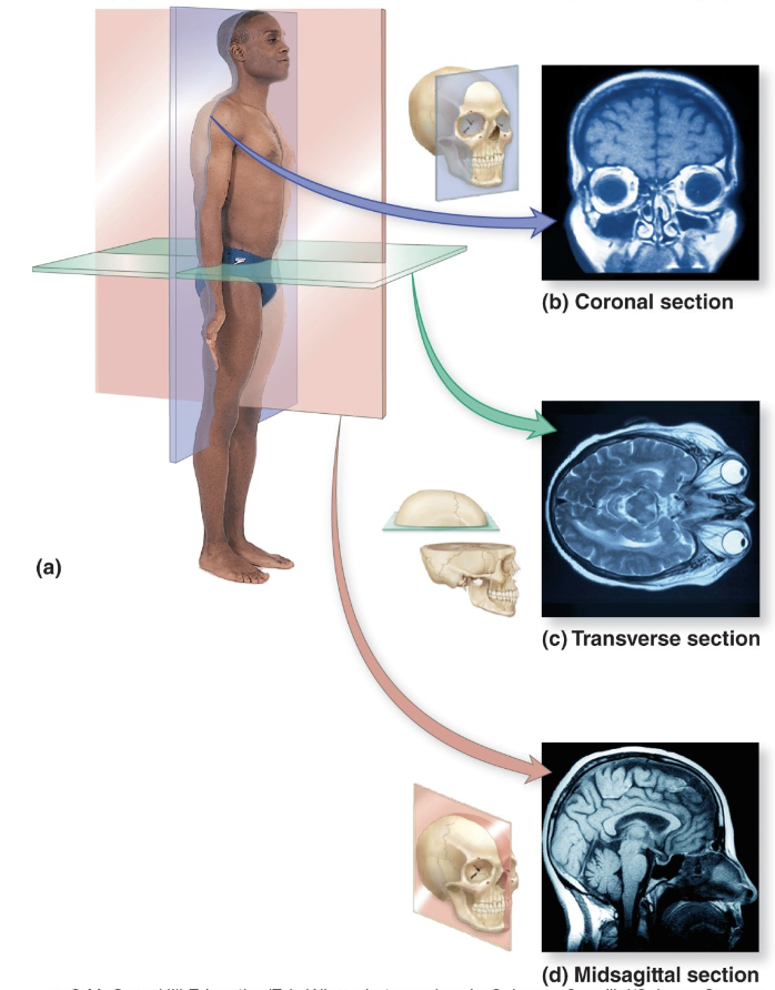 <p>Midsagittal (median) plane</p>