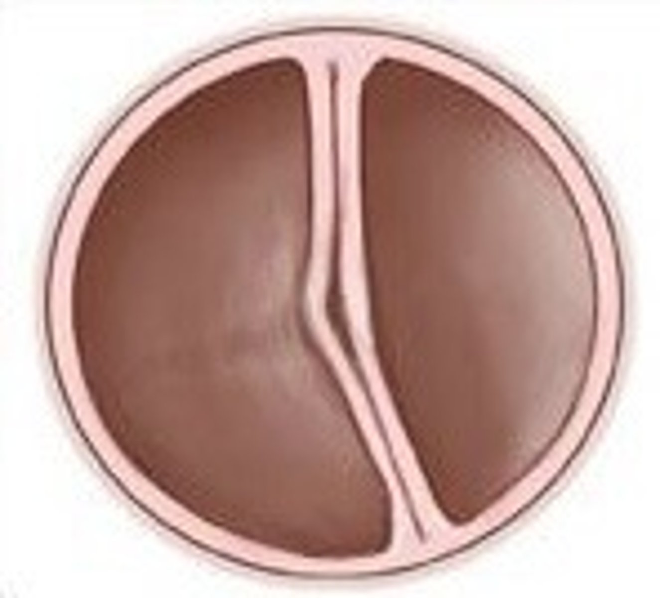 <p>Left AV valve (bicuspid)</p>